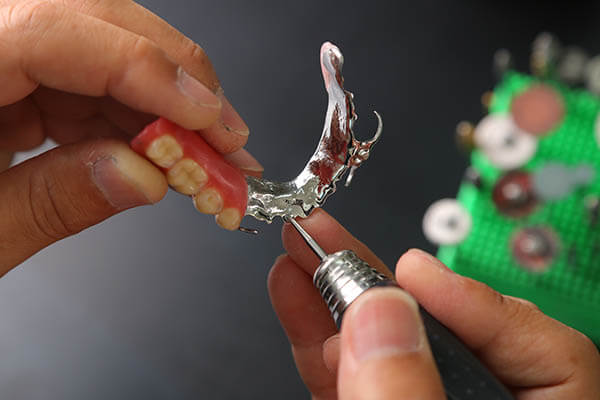 デンチャー部の歯科技工