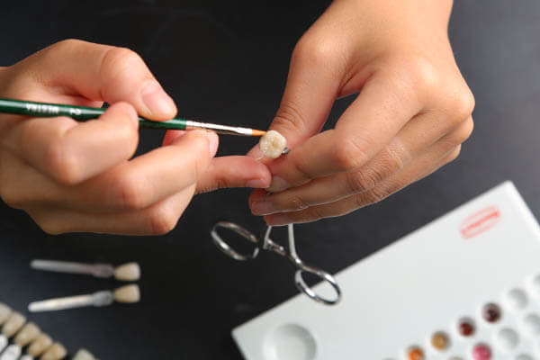 プレス・矯正・インプラントなどの歯科技工