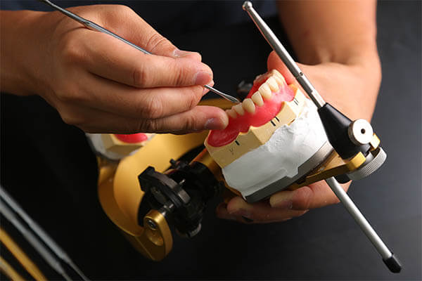 歯科技工の画像