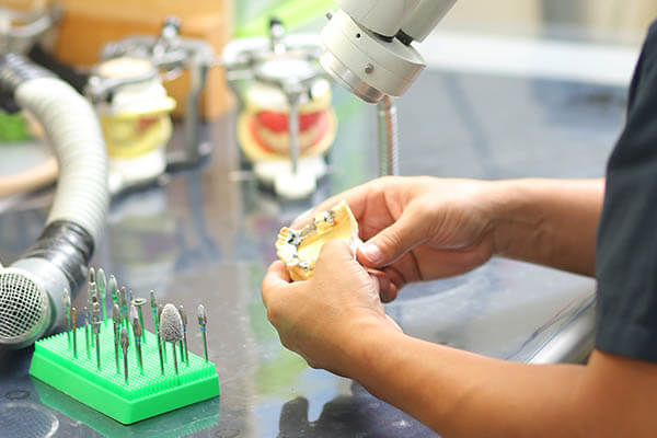 歯科技工の画像