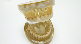 オールセラミックス